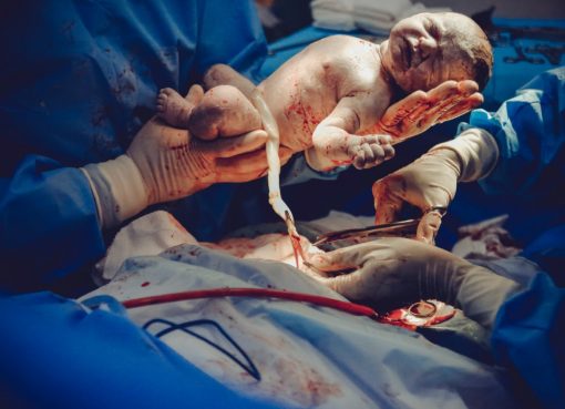 Photo by Vidal Balielo Jr. from Pexels